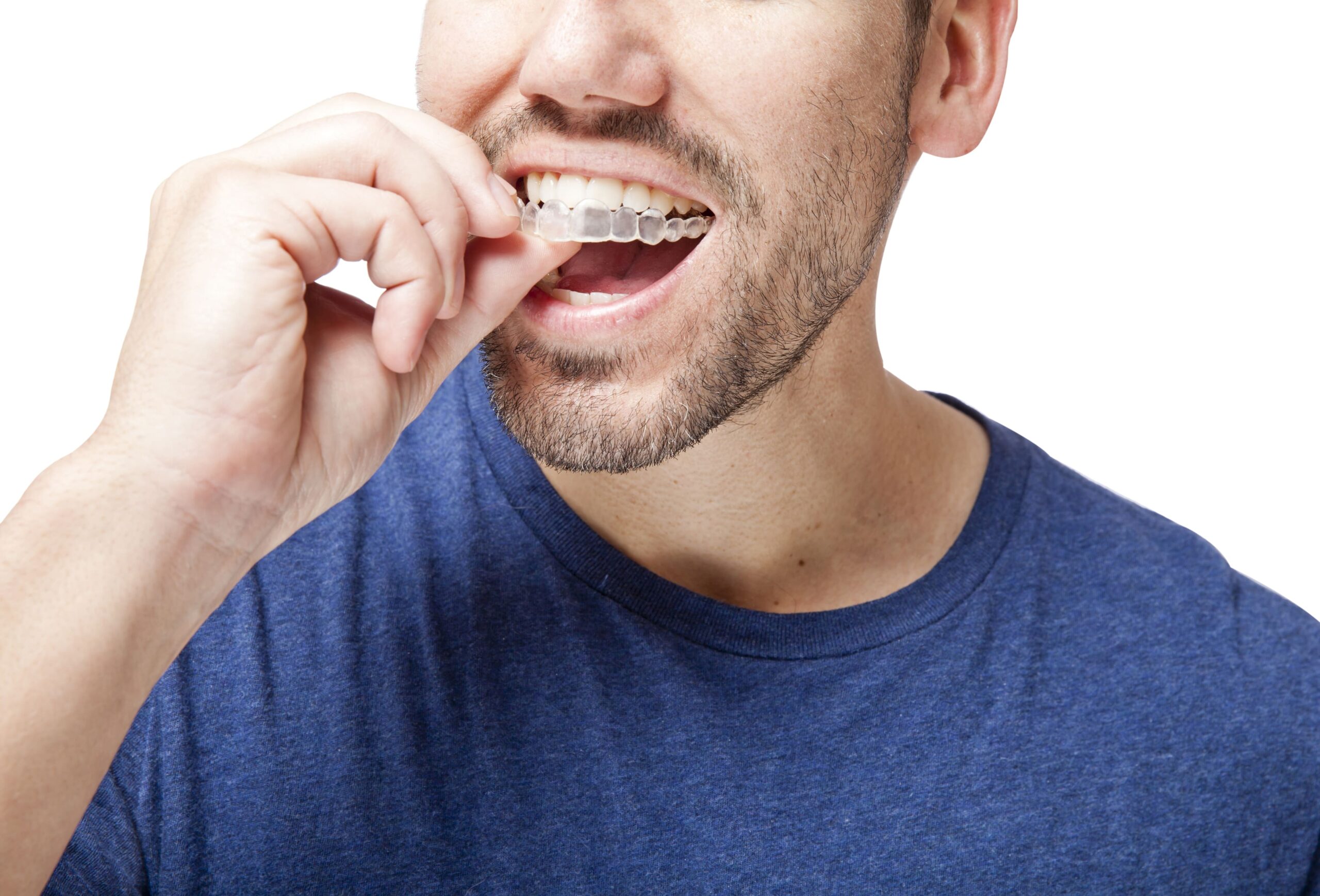 dos and don'ts for invisalign