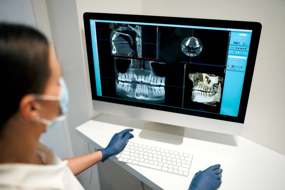 the importance of dental x-rays in oral health