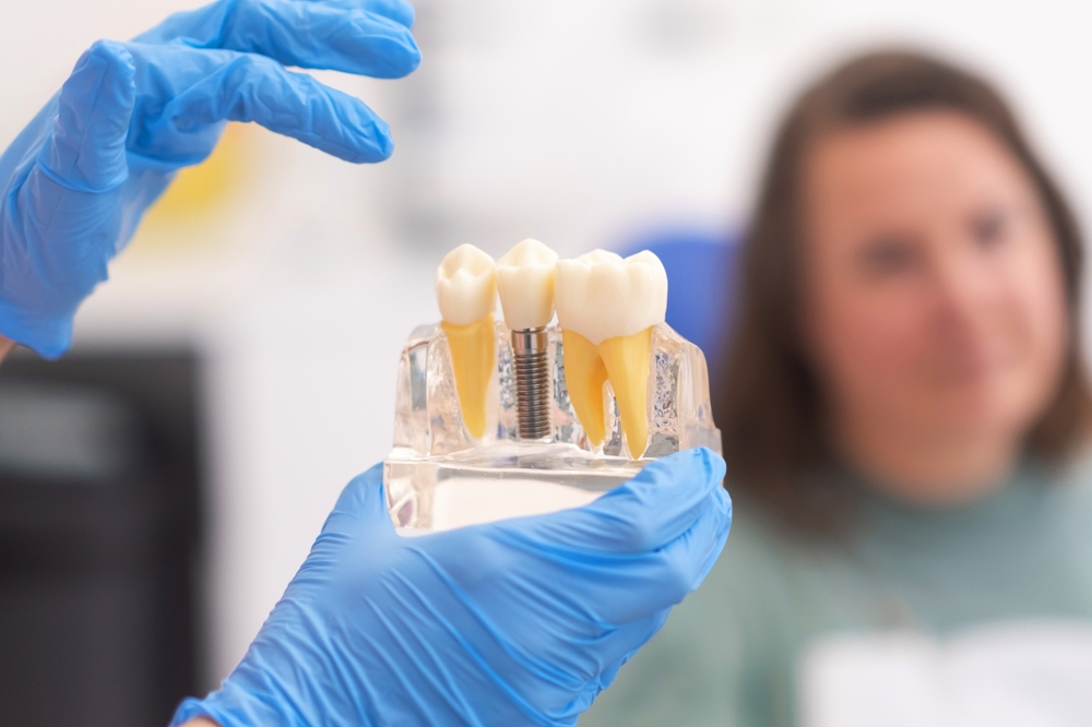tips for maintaining your dental implants
