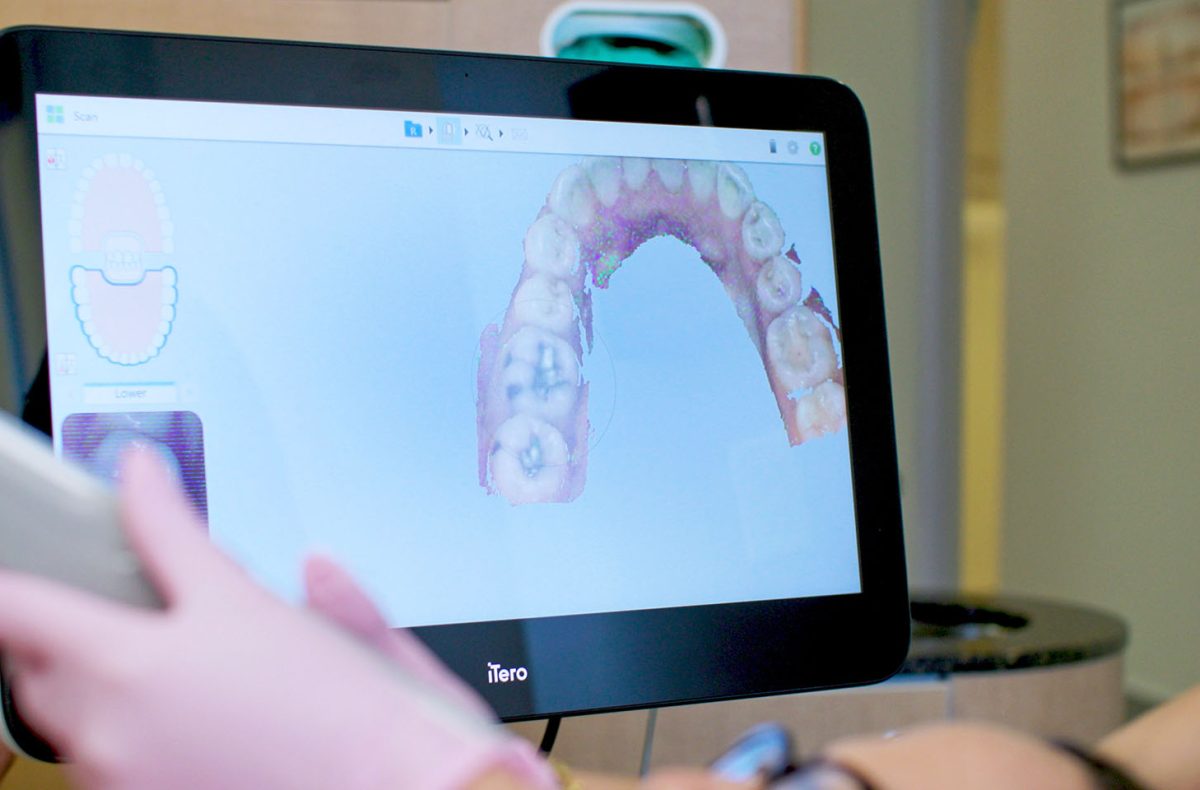 Invisalign Dentists Cooper City Fl